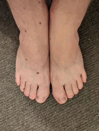 @hairyhobbittoes