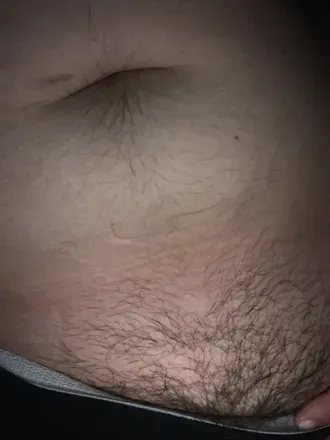 @tfortrans