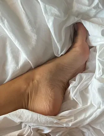 @feetbirthmark
