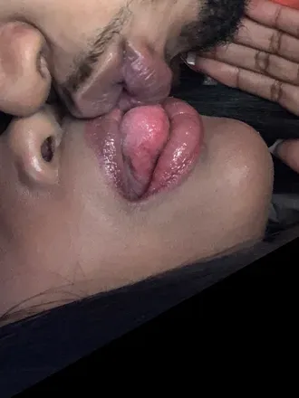 @skyn2skyn