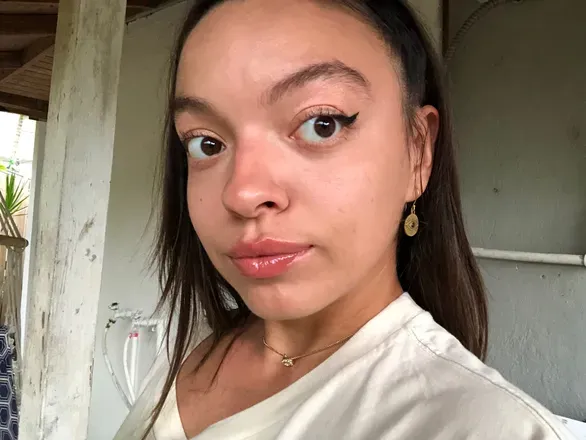 @lazersneverdie
