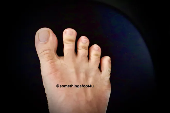 @somethingafoot4u