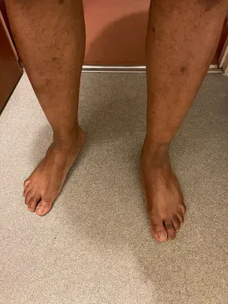 @hot-fetish