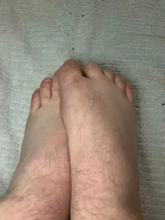 @foot.crush.of