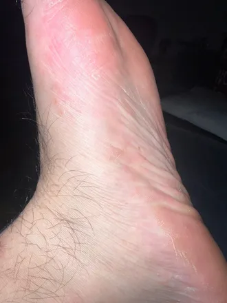 @feetstriper