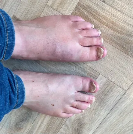 @baconfeetuk