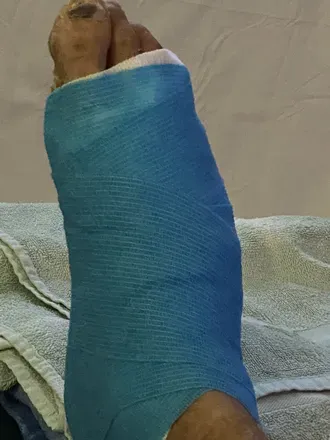 @zomfoot