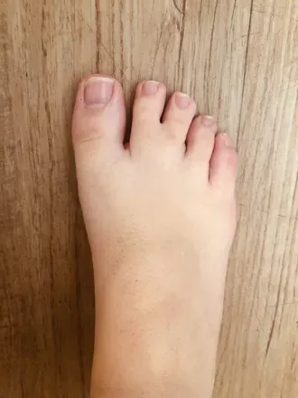 @pigeontoeliving
