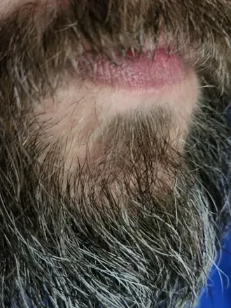 @thebeardedhelmet