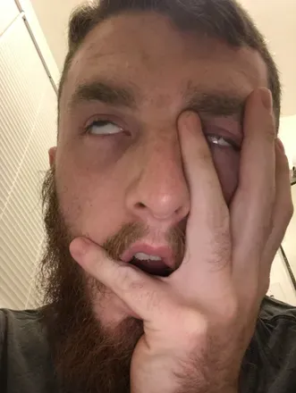 @thathairydude