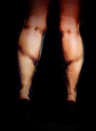 @womanwithmuscularcalves