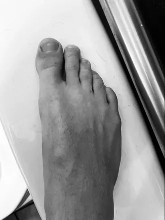 @toenail_twink