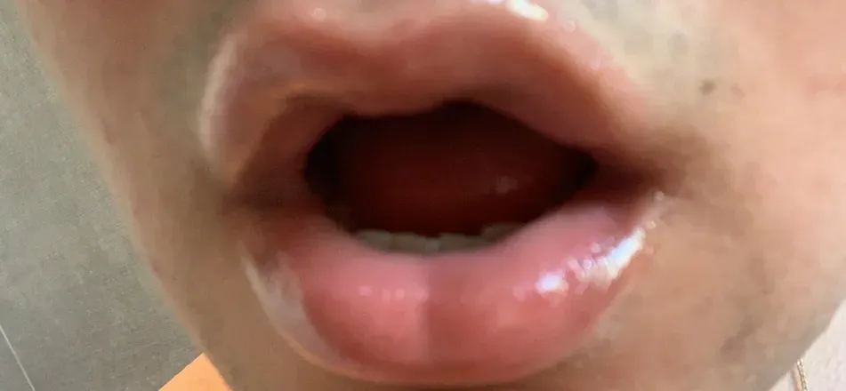 @nycthroat
