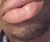 @novvacane0